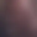 Chat with  yedel9659683423
